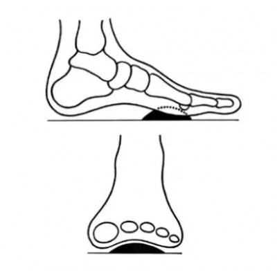 Т-подібна вставка для підтримки поперечного склепіння SHP-110 8x14 см - розмір M